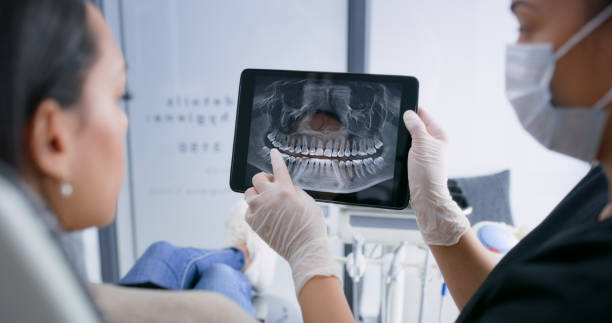 Licensed Tooth Extraction service in Roslyn, NY - Smile Center Dentistry